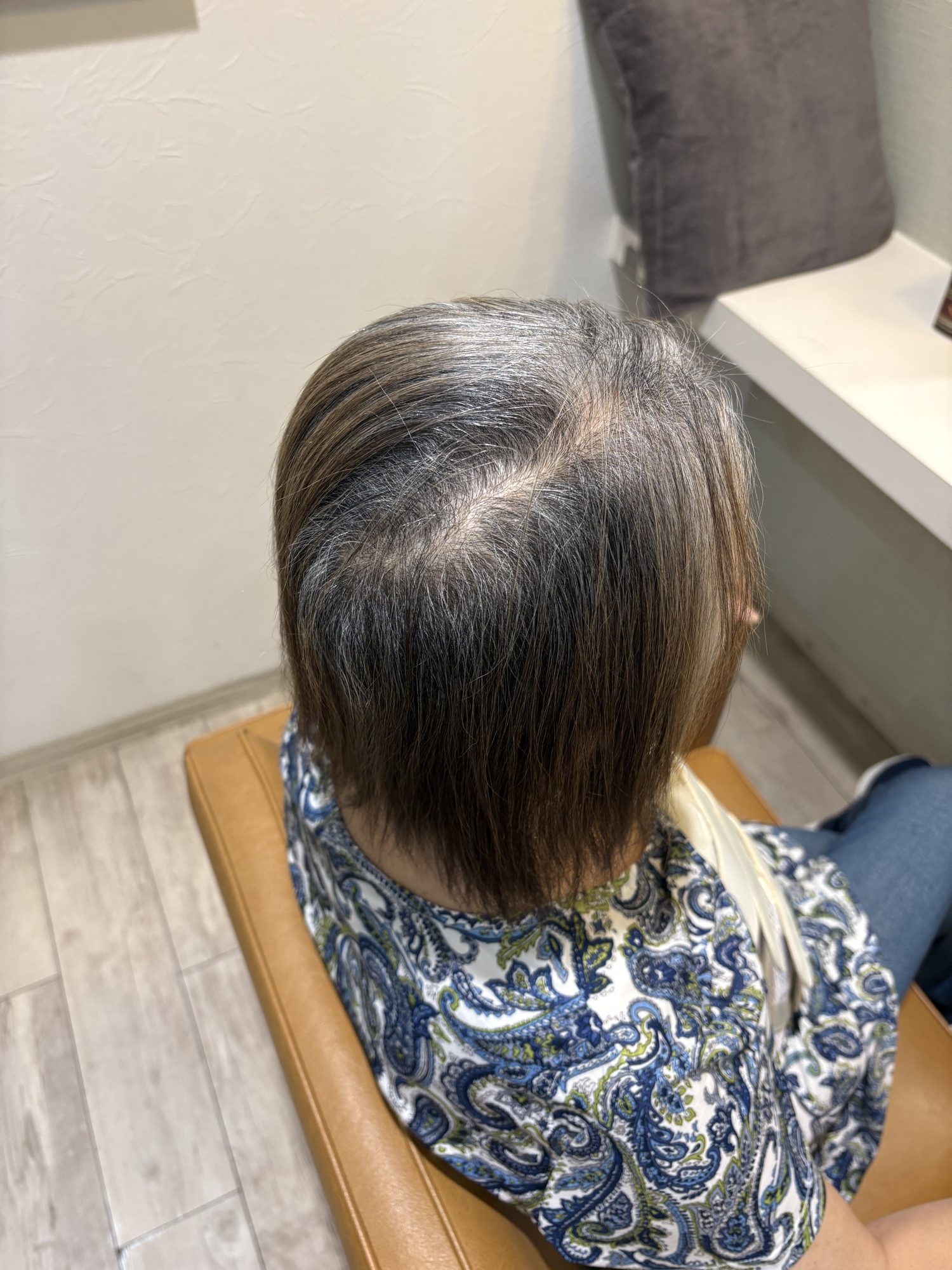 施術前